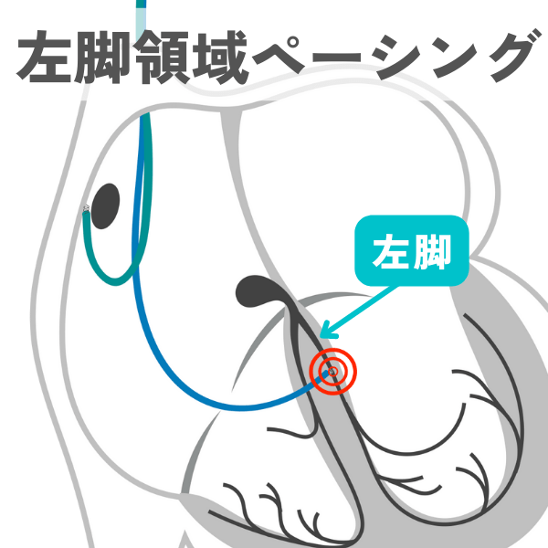 画像に alt 属性が指定されていません。ファイル名: LBBA%E3%83%9A%E3%83%BC%E3%82%B7%E3%83%B3%E3%82%B0.png